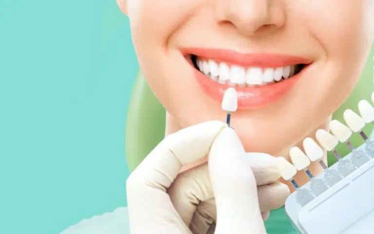 Choosing the right materials for your dental veneers