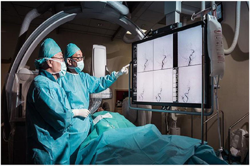 angiography device supplier